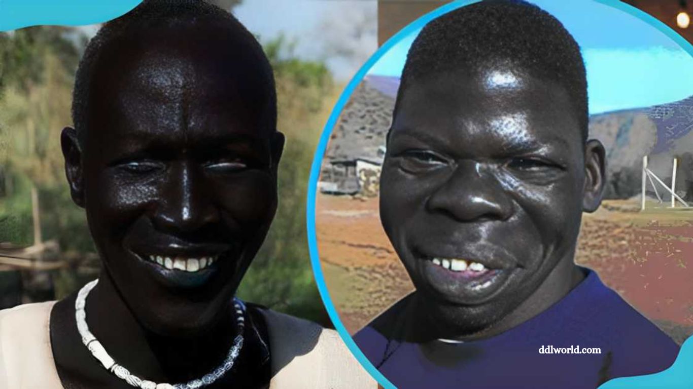 Exploring the Darkest Complexion on Earth